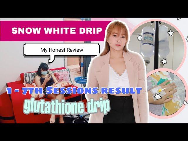 Glutathione Drip | Snow White Drip 1 - 7th Sessions Review! #SnowWhiteDrip #GlutathioneInjections