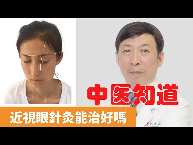 近視眼針灸能治好嗎【保健養生】生生不息┃