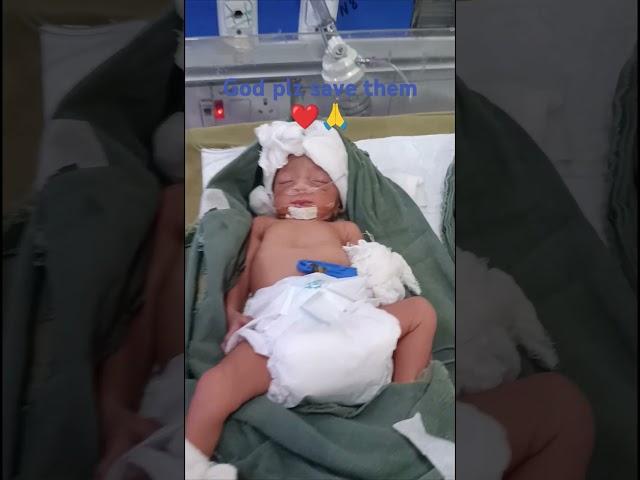 #youtube #youtubeshorts #newbornbaby #littlelife #music #cutebaby #nicu ... 🩺