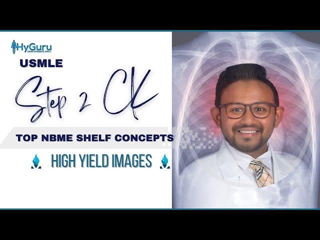 Top NBME Images (Radiology) | USMLE Step 2 CK 🩻