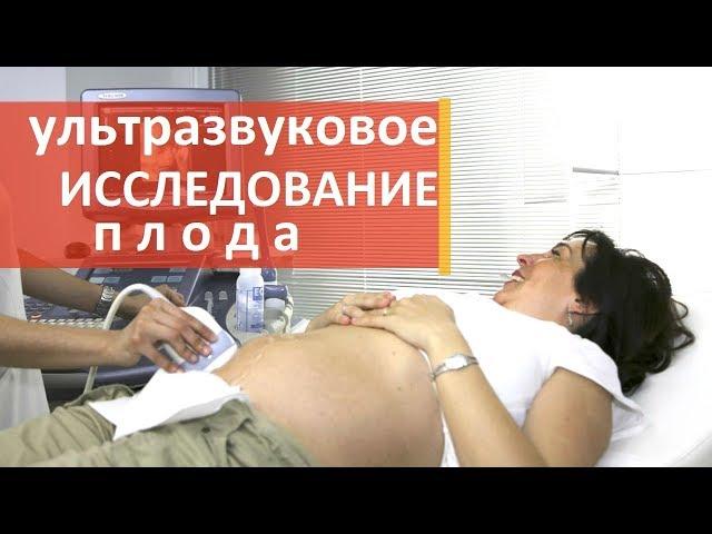 Узи исследование.  Экспертное узи исследование плода.  Мать и Дитя