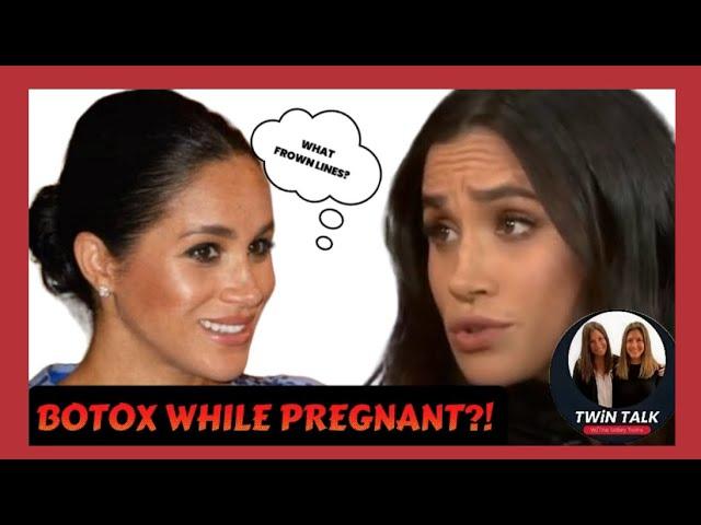 TWiN TALK: What happened to Meghan Markle’s frown lines???