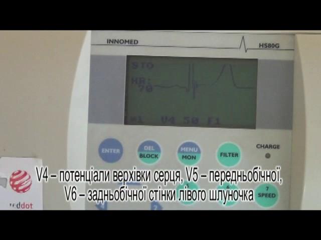 OSCE-1.НМУ ім.О.О.Богомольця.Методика реєстрації ЕКГ (офіційна версія)