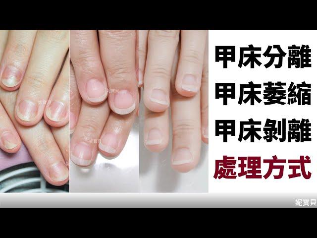 甲床分離(萎縮 剝離)產生的原因與處理方式