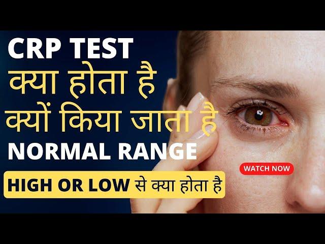 CRP test kya hota hai | crp test in hindi | crp test normal range | crp high hone se kya hota hai