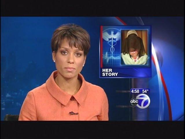 ABC News (NY) - Charla Nash, victim of chimp attack (Nov 11, 2009)