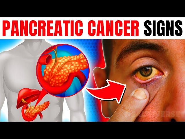 12 EARLY Warning Signs Of Pancreatic Cancer You Are Ignoring!