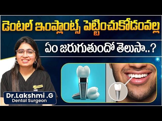 What are Dental Implants | How do They Work | Benefits of Dental Implants |Eledent Dental Hospitals