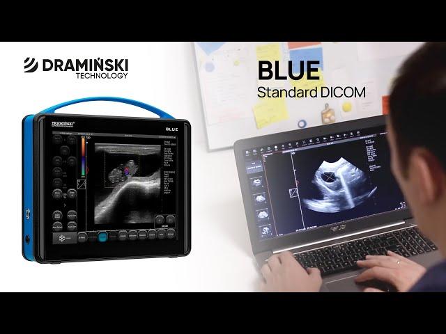 Tele-ultrasound. DICOM compatible files. How does it work? DRAMIŃSKI BLUE ultrasound scanner (en)