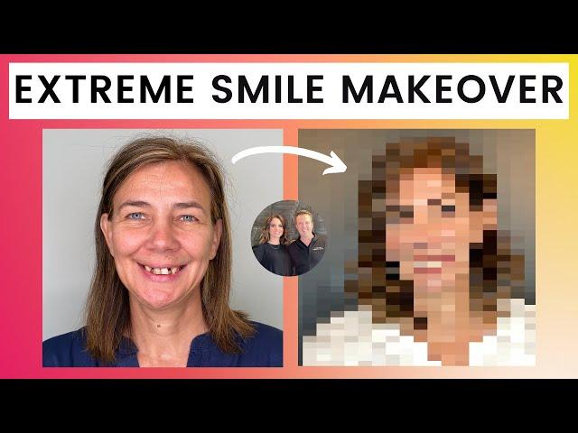 SMILE MAKEOVER BEFORE & AFTER | COSMETIC DENTISTRY