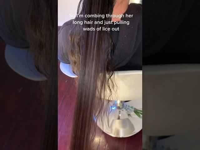 Hairdresser shares video of hair lice INFESTATION on child with 'more lice than strands of hair'