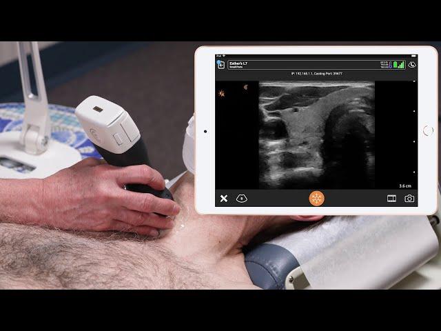 Thyroid - Ultrasound Scanning Technique