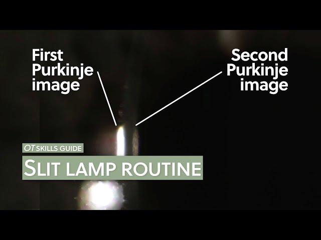 OT skills guide: Slit lamp routine