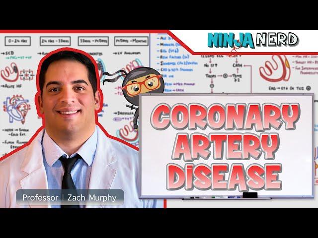 Coronary Artery Disease | Clinical Medicine