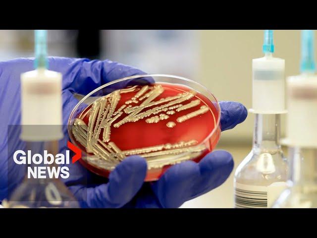 E. coli outbreak: How to protect yourself from bacteria, infection?