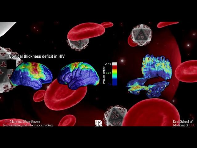 USC Mark and Mary Stevens Neuroimaging and Informatics Institute: Past and Present