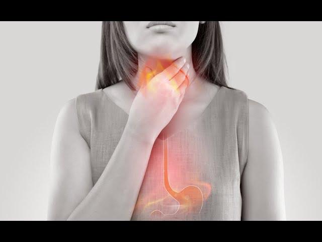 Managing GERD and Acid Reflux with Cancer