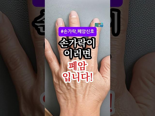 손가락 끝이 이렇게 변하면 폐암 신호일 수 있습니다! #건강정보 #건강