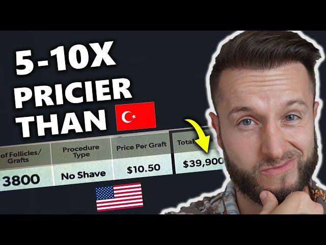 40k Hair Transplant in the USA! Rip Off or Worth It!?