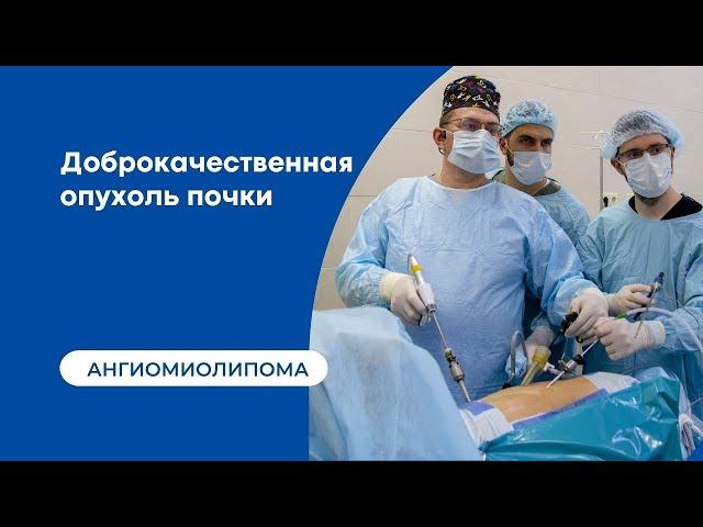 Лечение ангиомиолипомы | доброкачественная опухоль почки