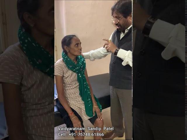 Rheumatoid Arthritis Ayurvedic Treatment - By Vaidyaratnam Sandip Patel