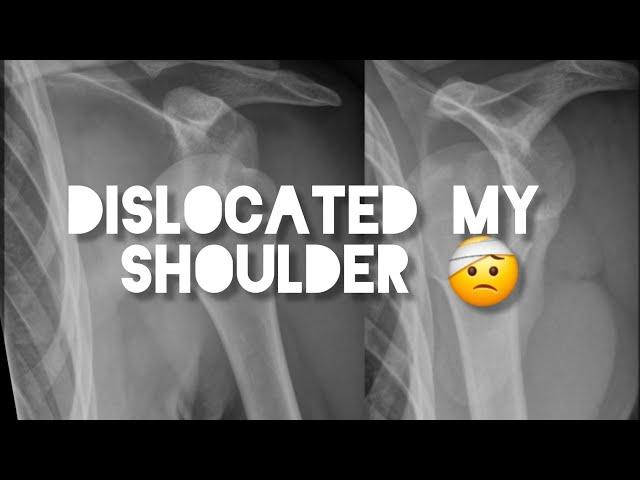 DISLOCATED SHOULDER IS A VERY EXCRUCIATING PAIN. AM I WRONG?