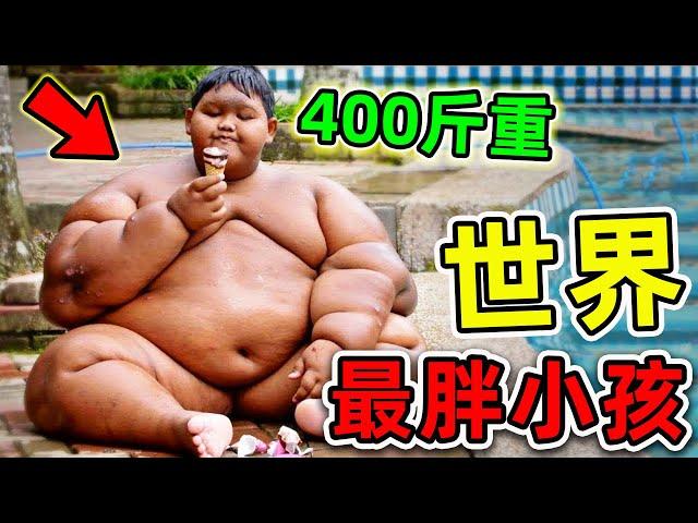 全世界最胖的10個小孩！10歲體重超過400斤，比同齡人更胖10倍，如今卻是“國民男神”！|#世界之最top #世界之最 #出類拔萃 #腦洞大開 #top10 #最胖小孩 #最胖的人