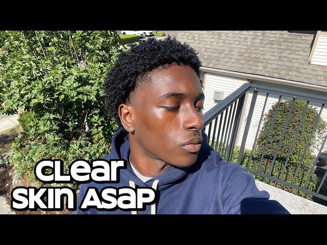 how to get clear skin for guys asap