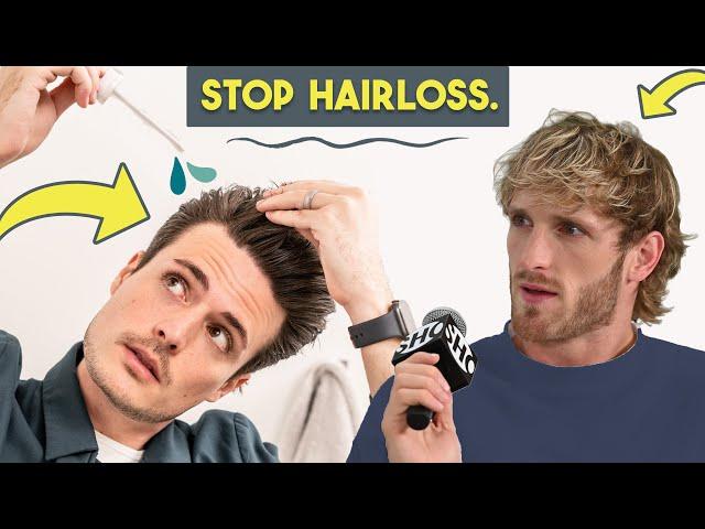 Going Bald?? Here's What You Can ACTUALLY DO | Hair Loss Prevention