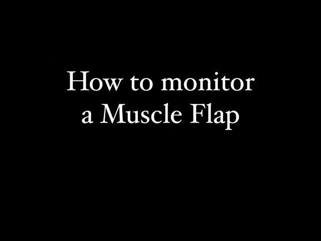 MONITORING MUSCLE FLAPS