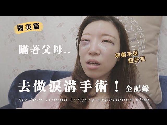 去做淚溝手術！醫美體驗全記錄Vlog，大成功！