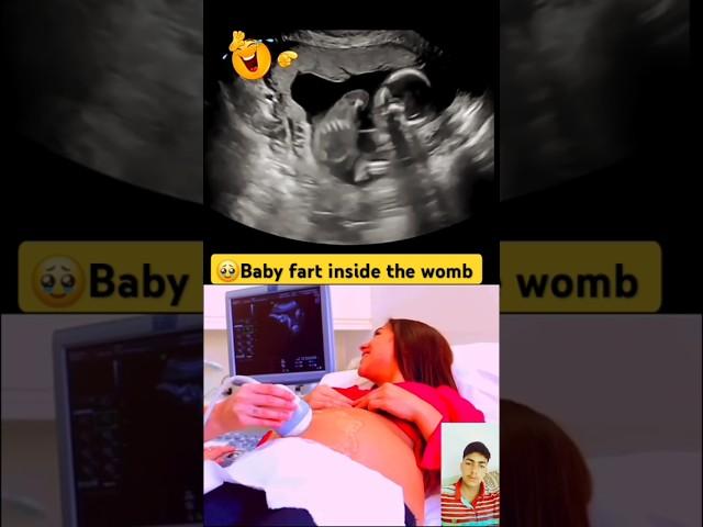 Baby farts inside the womb showing ultrasound #short