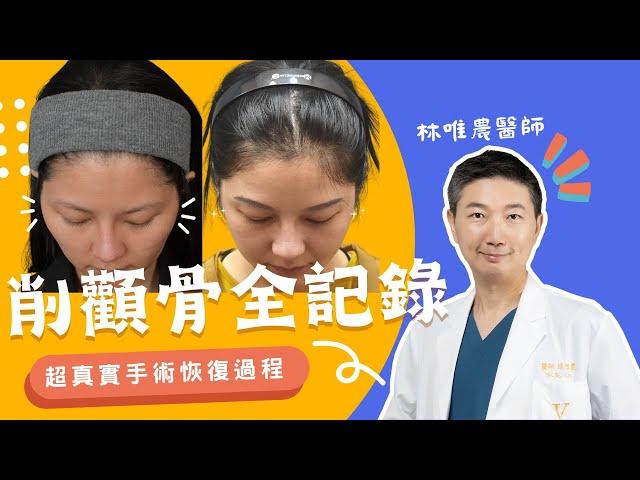 骨頭不用削！顴骨內推手術超真實記錄！｜凡登整形外科 林唯農醫師