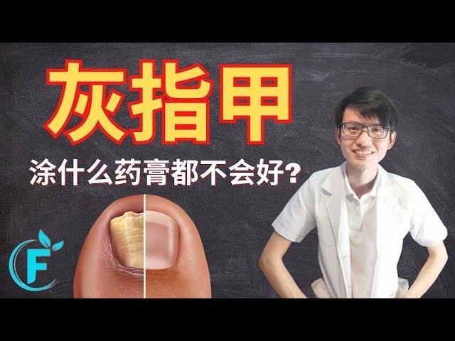 我的灰指甲涂了很多药膏就是不会好，到底怎么办？ |【灰指甲】花生健康医药 EP164