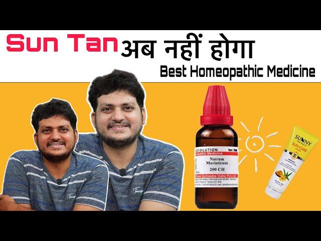 Sun tan अब नही होगा | Best Homeopathic Medicine for Sun tan ?