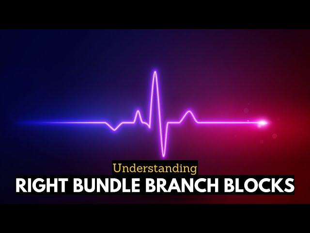 RBBB Uncovered: Navigating the Complexities of Right Bundle Branch Blocks