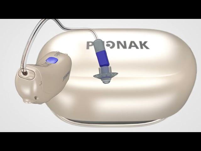 Introducing Phonak Audéo™ Lumity