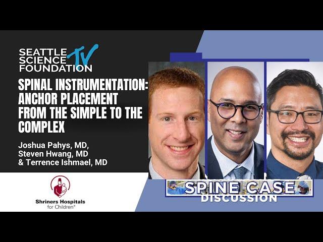 Spinal instrumentation: Anchor placement from the simple to the complex - Shriners Hospital