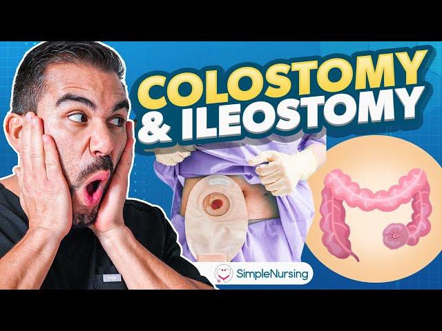 Colostomy and Ileostomy Nursing | Indications, Complications, Care EASY