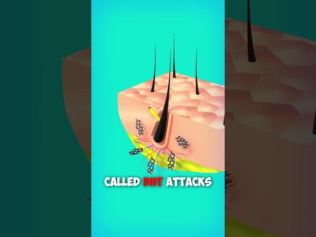 Why Hair Loss? Explained with 3d Animation. #shorts #animation #hair #education