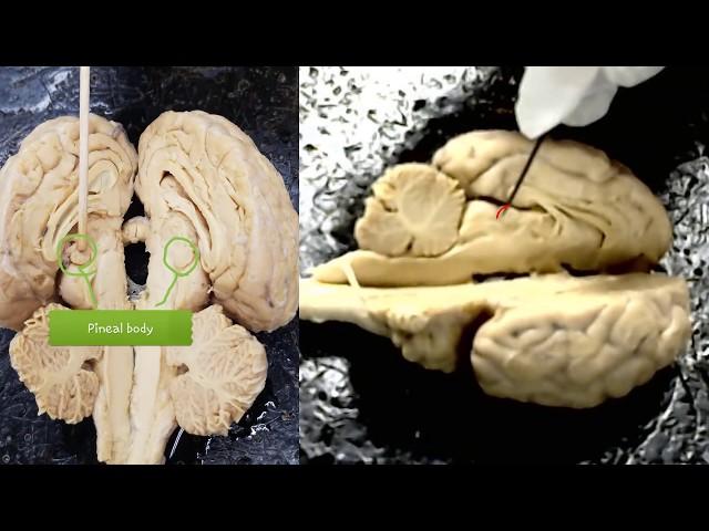 anatomy of the sheep brain video for anatomy class - practice for the practical exam