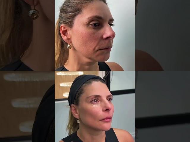 Advanced Surgical Techniques with Dr. Daniel Diaz Torrado A Step-by-Step Guide