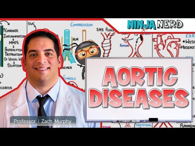 Aortic Diseases | Clinical Medicine