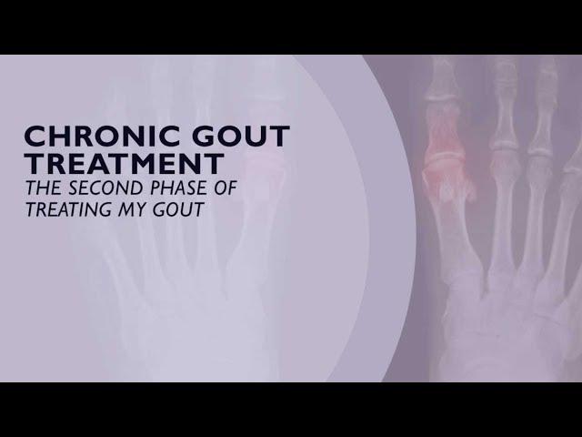 Chronic Gout Treatment - The Second Phase of Treating Gout (6 of 6)