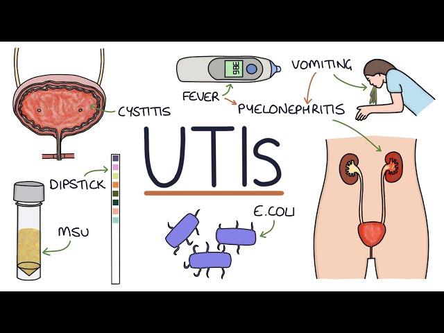 Understanding Urinary Tract Infections