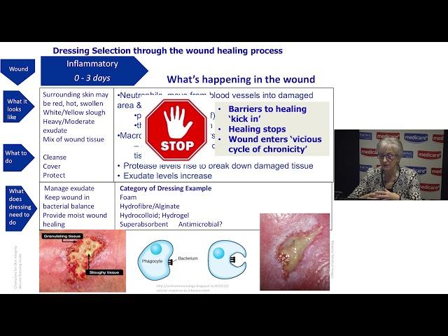 Understanding Wound Dressings Categories and Indications