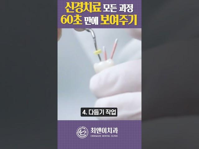 신경치료 모든 과정 단 60초 만에 보여드릴게요! #shorts