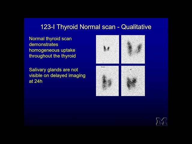 Thyroid functioning imaging