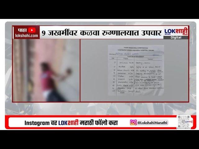 Mumbai। Local Train Accident। लोकल अपघातातील जखमींवर कळवा रुग्णालयात उपचार; 10 जणांपैकी एकाचा मृत्यू