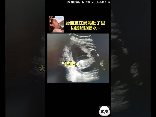 超聲記錄6個月大的胎寶寶邊噓噓邊喝水，網友1：神奇的生命是這樣的！網友2：別在那傻樂了，你在肚子裡的時候也一樣~（科普紀實，僅供娛樂，無不良引導）#shorts #DynamicChina